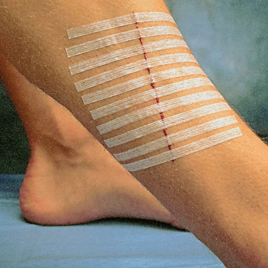 3M Steri-Strip Reinforced Adhesive Skin Closures R1547, 12 x 100mm, Blue - Box of 50