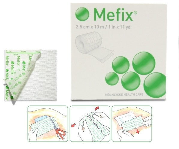 Molnlycke Mefix Self-Adhesive Fixation Fabric Tape 15cm x 10m (31599) - 1 Roll