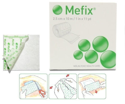 Molnlycke Mefix Self-Adhesive Fixation Fabric Tape 15cm x 10m (31599) - 1 Roll